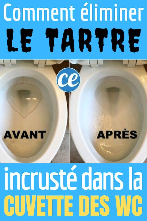 L'Astuce Simple Et Rapide Pour Blanchir Le Fond De La destiné Nettoyer Le Fond Des Toilettes