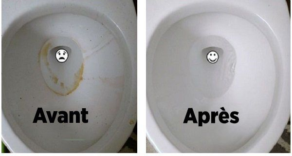 Voici Comment Avoir Des Toilettes Luisantes Sans Effort concernant Nettoyer Le Fond Des Toilettes