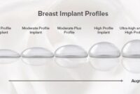 breast augmentation vs breast implants