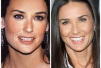 demi moore teeth surgery before and after