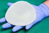 dd breast implant pictures