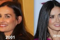 demi moore face surgery