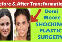 demi moore after plastic surgery