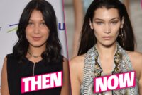 bella hadid plastic surgery vogue