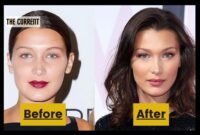 before and after bella hadid