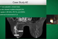 breast cancer margins prognosis