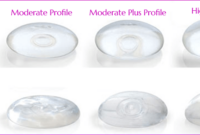 breast augmentation smaller size implants