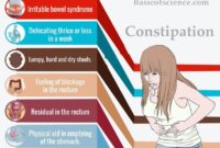 constipation pdf for patients