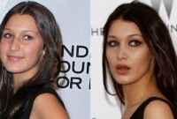 bella hadid before surgery