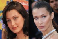 bella hadid before after