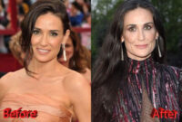 demi moore plastic surgery 2023