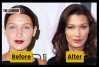 bella hadid before and after photos