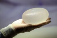 breast implants pictures