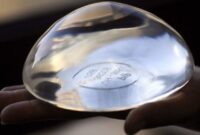 breast implants cost los angeles