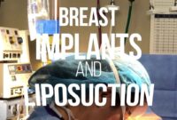 breast implants and tummy tuck