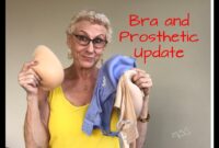 breast cancer prosthetics near me