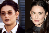 demi moore eye surgery