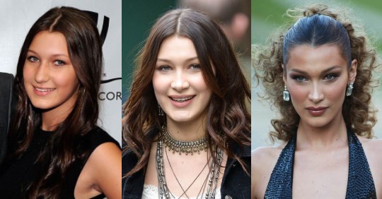 Bella Hadid's Before & After Surgery Evolution | ELLE Australia