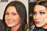 bella hadid prima e dopo