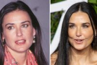 demi moore cosmetic surgery