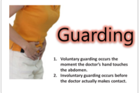 guarding abdomen