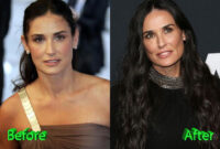 demi moore and plastic surgery