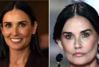 demi moore plastic surgery