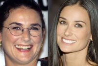 demi moore before and after implants