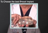 breast augmentation in los angeles risks