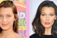 bella hadid before and after plastic surgery